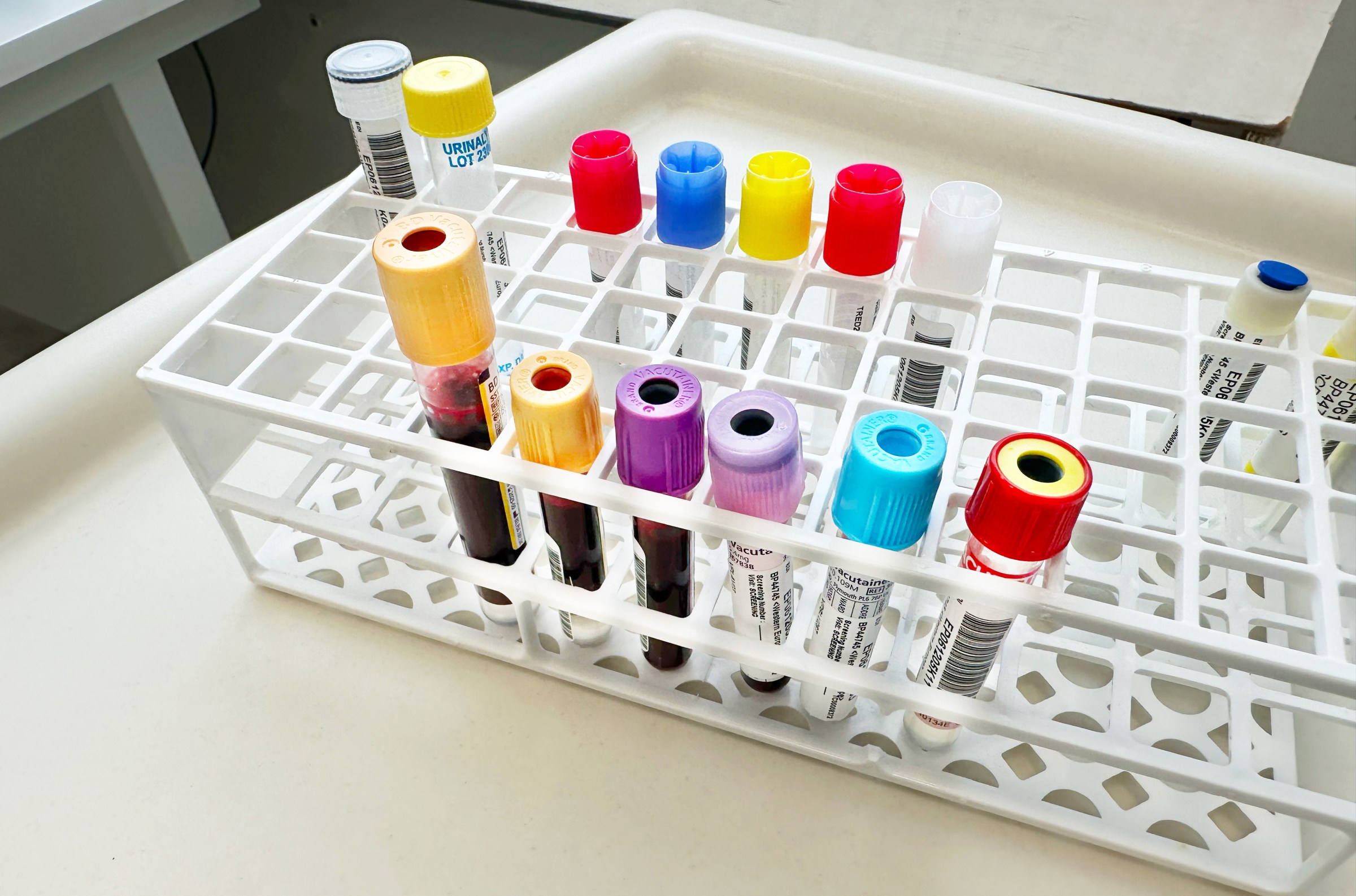 The real quest for fake blood