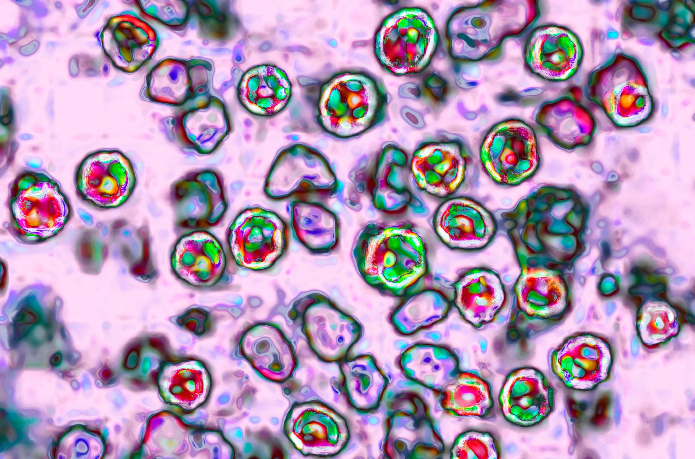 Can you still get measles even if you’ve been vaccinated?